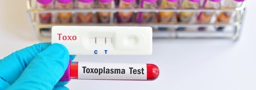  בדיקת נוגדני טוקסופלסמה (Toxoplasma IgM) - תמונה